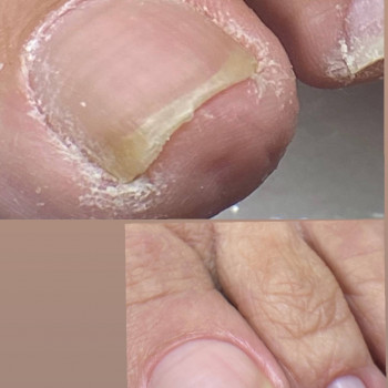 Педикюр
                    Мастер маникюра Наталья Кременчуг