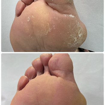 Педикюр
                    Мастер маникюра Наталья Кременчуг