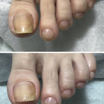 Педикюр
                    Мастер маникюра Наталья Кременчуг