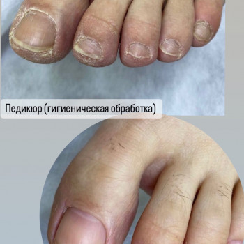 Педикюр
                    Мастер маникюра Наталья Кременчуг