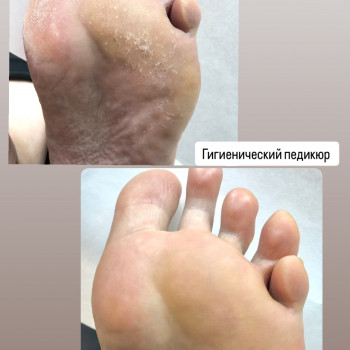 Педикюр
                    Мастер маникюра Наталья Кременчуг