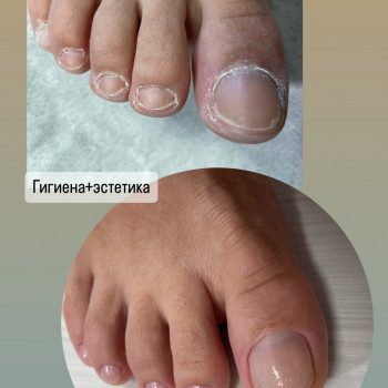 Педикюр
                    Мастер маникюра Наталья Кременчуг