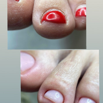 Педикюр
                    Мастер маникюра Наталья Кременчуг