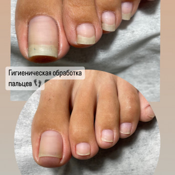 Педикюр
                    Мастер маникюра Наталья Кременчуг