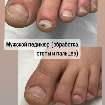Педикюр
                    Мастер маникюра Наталья Кременчуг