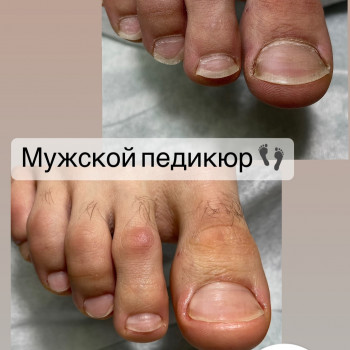 Педикюр
                    Мастер маникюра Наталья Кременчуг