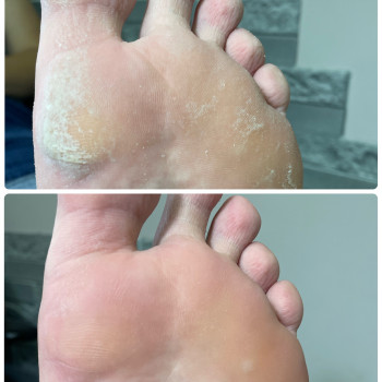 Педикюр
                    Мастер маникюра Наталья Кременчуг