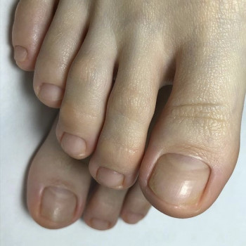 Педикюр
                    Мастер маникюра Наталья Кременчуг