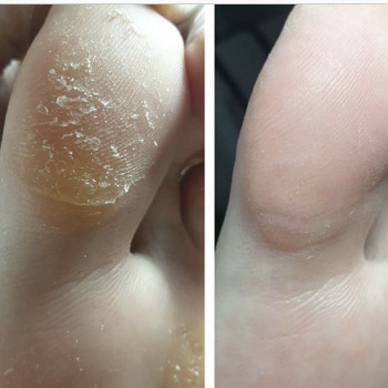 Педикюр
                    Мастер маникюра Наталья Кременчуг