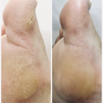 Педикюр
                    Мастер маникюра Наталья Кременчуг