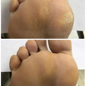 Педикюр
                    Мастер маникюра Наталья Кременчуг