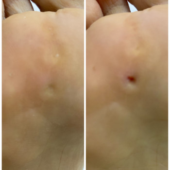 Педикюр
                    Мастер маникюра Наталья Кременчуг