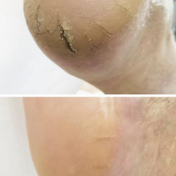 Педикюр
                    Мастер маникюра Наталья Кременчуг