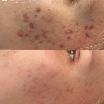 Алла Яценко, Кременчук Фото - 4