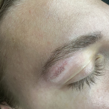 Микронидлинг
                    Мастер перманентного макияжа  Харьков