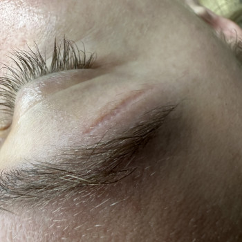 Микронидлинг
                    Мастер перманентного макияжа  Харьков