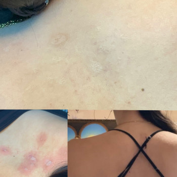 Микронидлинг
                    Мастер перманентного макияжа  Харьков