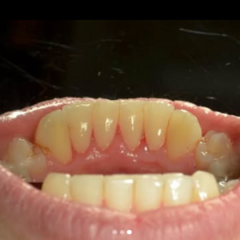 Стоматолог ADC, Черновцы Фото - 5