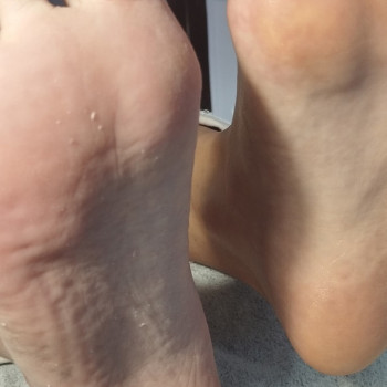 Гігієнічний педикюр до та після