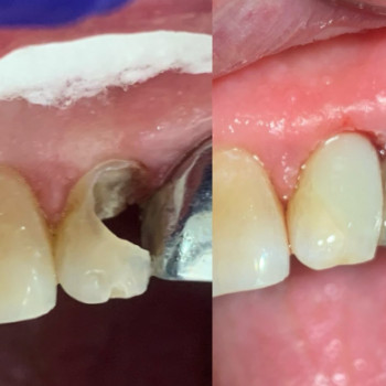 Dear Dent, Черновцы Фото - 5