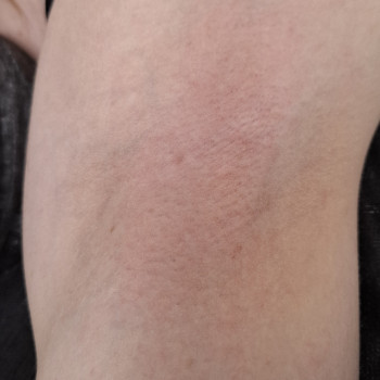 Катерина Василенко, Черкаси Фото - 5