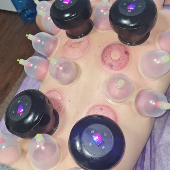 Вакуумно-баночна терапія (суха хіджама) загальна
                    Массажист Алена Хмельницкий