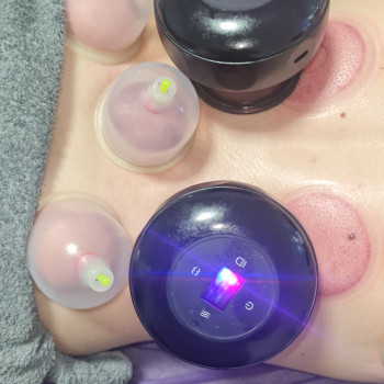 Вакуумно-баночна терапія (суха хіджама) загальна
                    Массажист Алена Хмельницкий