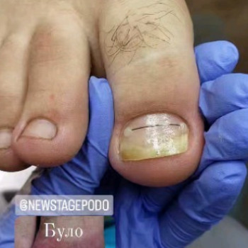 Дарія Круковська, Чернівці Фото - 5