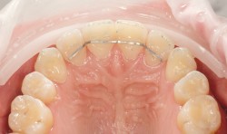 Професійна гігієна Стоматолог Андрей Киев