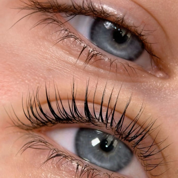 Заріна Білоус, Винница Фото - 5