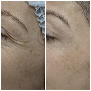 Людмила Патек, Ужгород Фото - 10