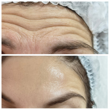 Людмила Патек, Ужгород Фото - 9