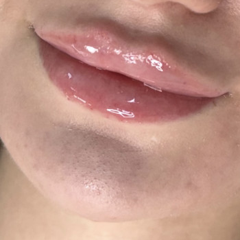 Губки👄
 #познякигуби #пластикагуб #контурнапластикагуб