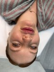 Контурна пластика губ Косметолог-ін'єкціоніст Liubov Київ