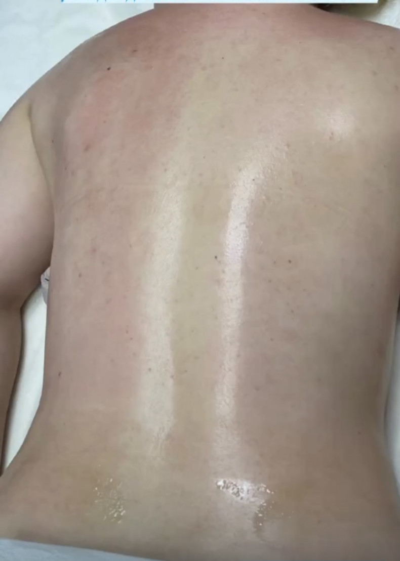 Роблю такі види масажу:
🍀шийно-комірцевої зони;
🍀-спини;
🍀-обличчя;
🍀загальний (спина,ноги,руки,живіт )
🍀-спортивний;
🍀-антицелюлітний ручний;
🍀-антицелюлітний сольовий;
🍀-Стоун масаж;
🍀ОБГОРТАННЯ продукція PELOVIT-R (на основі витяжки грязей із Куяльника)
🍀Тейпування 
Запишіться вже сьогодні (найкраще у телеграм)💌 
 #масаж, фото - Массажист Татьяна Массаж