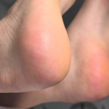 Наталія Куцук, Луцьк Фото - 5