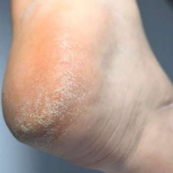 Наталія Куцук, Луцьк Фото - 6