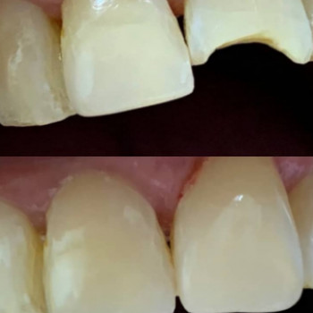 K Dent, Луцк Фото - 5