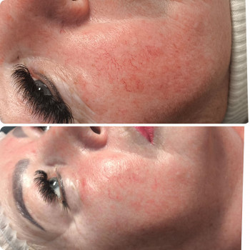 Алена Честюхіна, Каменское Фото - 7