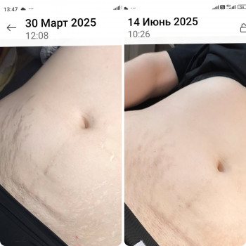 Алена Честюхіна, Каменское Фото - 8