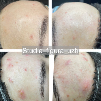 Екзосоми
                    Косметолог-естетист Зинаида Ужгород