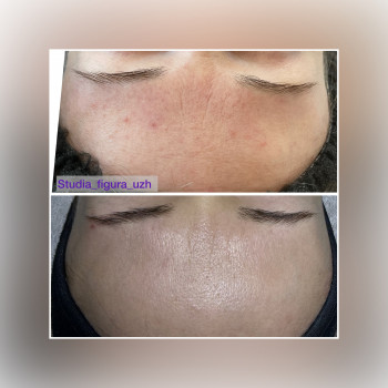 Екзосоми
                    Косметолог-естетист Зинаида Ужгород