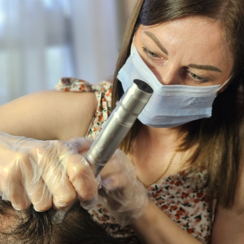 Фракційна мезотерапія шкіри голови