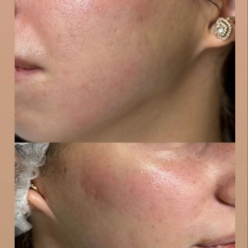 Олена Яцейко, Львів Фото - 5