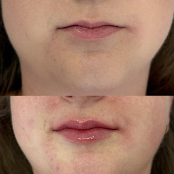 Оксана Пукій, Львів Фото - 5