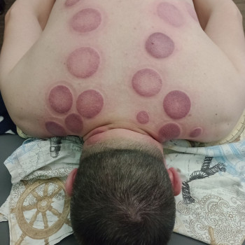 Вікторія Батура, Буча Фото - 5