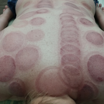 Вікторія Батура, Буча Фото - 6