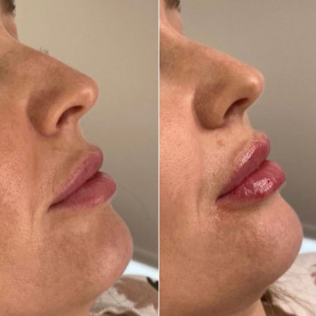 Ірина Ружницька, Львів Фото - 5