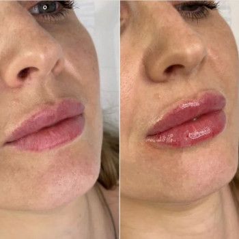 Ірина Ружницька, Львів Фото - 7