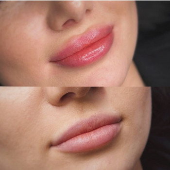 Андрій Ільницький, Львів Фото - 5